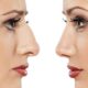 بهترین جراح بینی در ساری