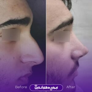 نمونه کار دکتر ابوالفضل عباس زاده