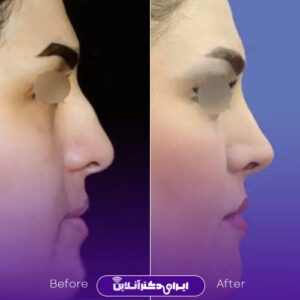 نمونه کار دکتر سهراب براتی 1