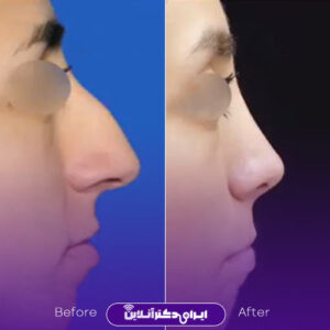 نمونه کار دکتر سهراب براتی 2