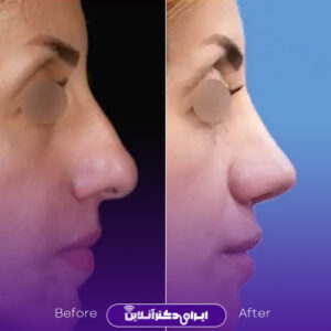 نمونه کار دکتر سهراب براتی 3