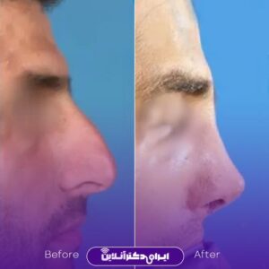 نمونه کار دکتر سهراب براتی 4