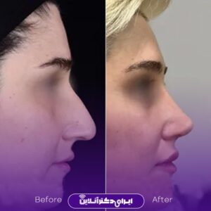 نمونه کار دکتر امیر دریانی