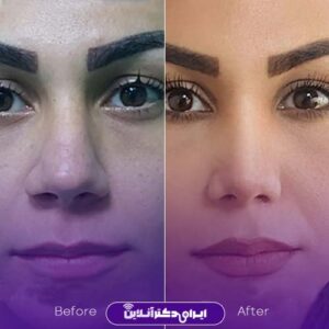 نمونه کار دکتر نیلوفر رحیمی پور