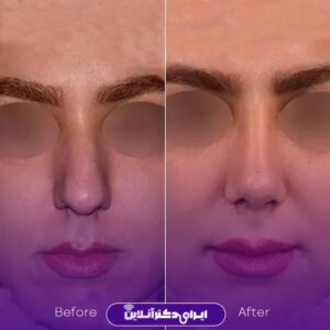 نمونه کار دکتر روزینا بشارتی زاده