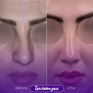 نمونه کار دکتر روزینا بشارتی زاده