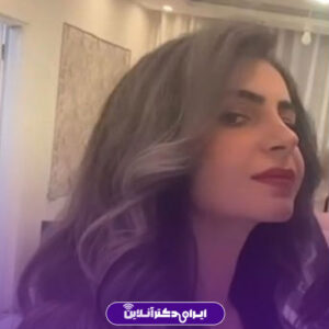 نمونه عمل بینی زنانه دکتر عرفانیان مشهد