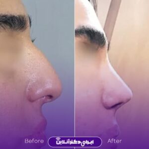نمونه کار دکتر علیرضا مومنی افجدی 2