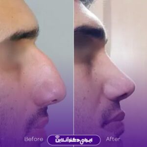 نمونه کار دکتر علیرضا مومنی افجدی 4