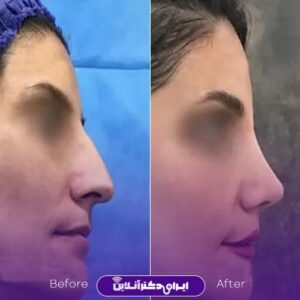 نمونه کار دکتر ایرج وکیلی