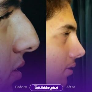 نمونه کار دکتر سید حنیف اخوت 3
