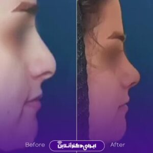 نمونه کار دکتر علی حسینی واجاری