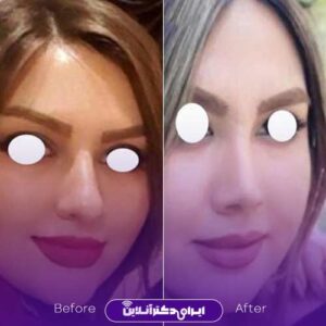 نمونه کار دکتر نسیم کوشا