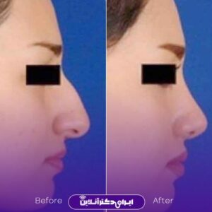 نمونه کار دکتر نوشین فتوحی