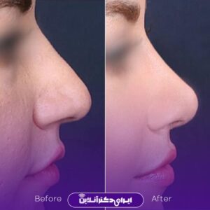 نمونه عمل های بینی دکتر سعیدرضا توفیقی