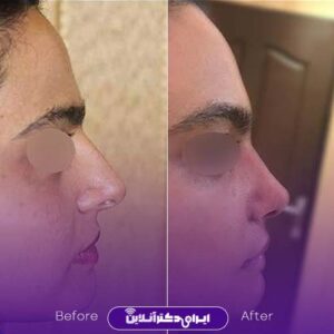 نمونه کار دکتر نگین نجمی