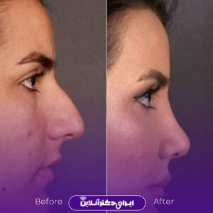 نمونه کار دکتر مریم تهرانی رشت