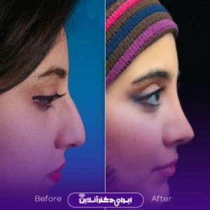 نمونه کار دکتر حاتمی پور شیراز