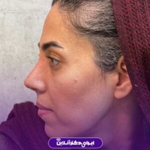 نمونه کار دکتر نگار جعفری