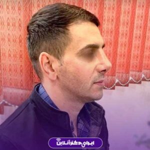 نمونه کار دکتر متدین جراح بینی در مشهد