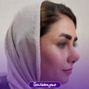نمونه کار دکتر زهره متدین مشهد