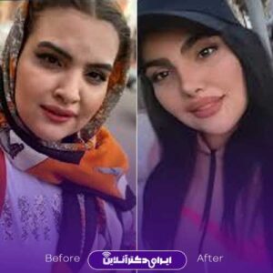 تصویر نمونه عمل دکتر متدین مشهد