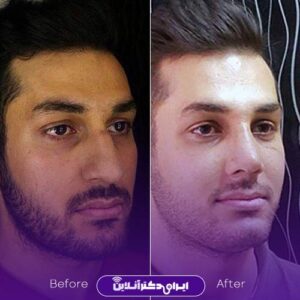 عکس عمل بینی دکتر اشتری