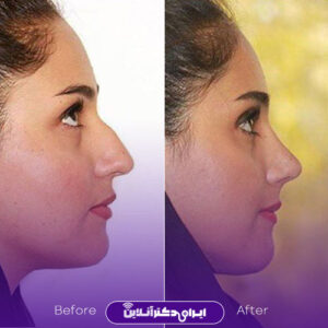 نمونه کار دکتر ارسطو اشتری تهران