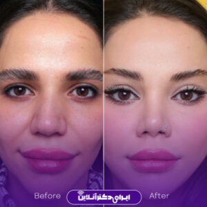 نمونه کار دکتر سامان طهماسبی