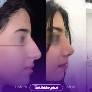 عکس نمونه کار دکتر قربانی