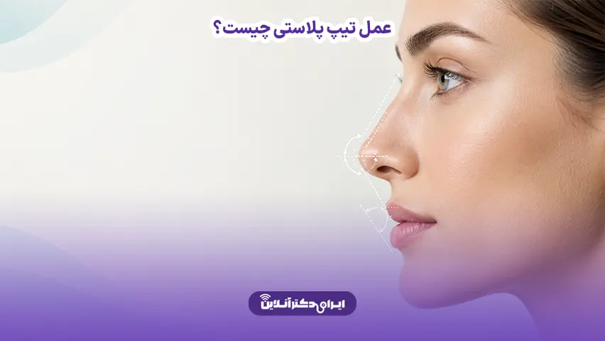 عمل تیپ پلاستی چیست