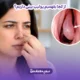 از کجا بفهمیم پولیپ بینی داریم؟