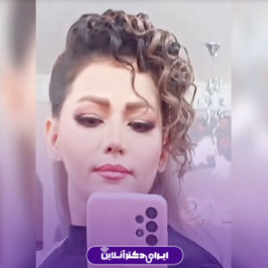 نمونه کار دکتر هدی اسماعیل پور مشهد