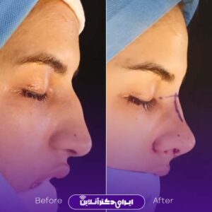 نمونه کارهای دکتر مجتبی سبحان پور شیراز