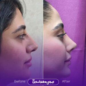 نمونه کارهای دکتر سبحان پور شیراز