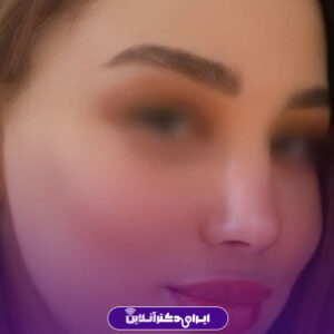 نمونه کار دکتر عباس رنگین جراح بینی مشهد