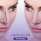 عمل بینی طبیعی