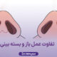 تفاوت عمل باز و بسته بینی