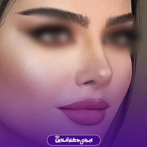 بهترین جراح بینی گوشتی در تهران + معرفی 20 پزشک برتر 72 نمونه کار جراحی بینی گوشتی دکتر باباجانی در تهران 1