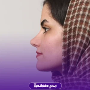 نمونه کار عمل بینی دکتر افشین باقری 1