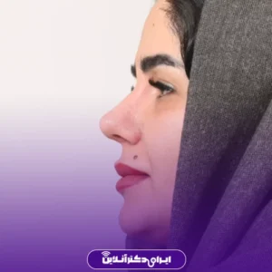 نمونه کار عمل بینی دکتر افشین باقری 3