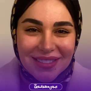 نمونه کار عمل بینی دکتر افشین باقری 4