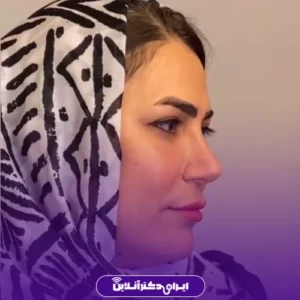نمونه کار عمل بینی دکتر افشین باقری 9