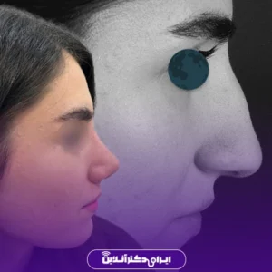 نمونه کار عمل بینی دکتر علی فقیه حبیبی 2