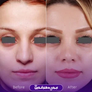 نمونه کار عمل بینی دکتر علی فقیه حبیبی 6