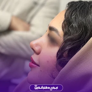 نمونه کار عمل بینی دکتر آرش نجف بیگی 1