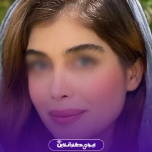 نمونه کار عمل بینی دکتر بهنام خرمی 1