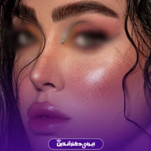 نمونه کار عمل بینی دکتر بهنام خرمی 3
