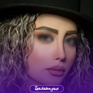 نمونه کار عمل بینی دکتر بهنام خرمی 4