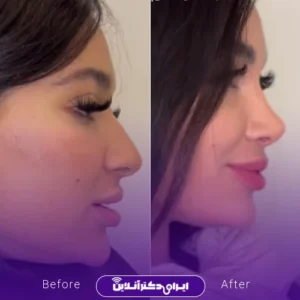 نمونه کار عمل دکتر حمیدرضا مفرد 1